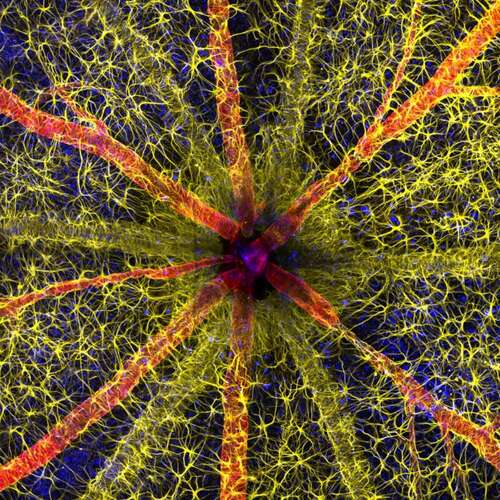 a rodent optic nerve head with astrocytes (yellow), contractile proteins (red), and retinal vasculature (green).