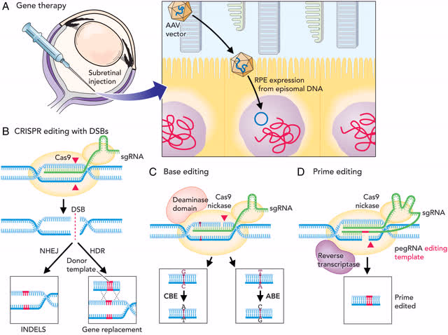 DNA editing in the eye