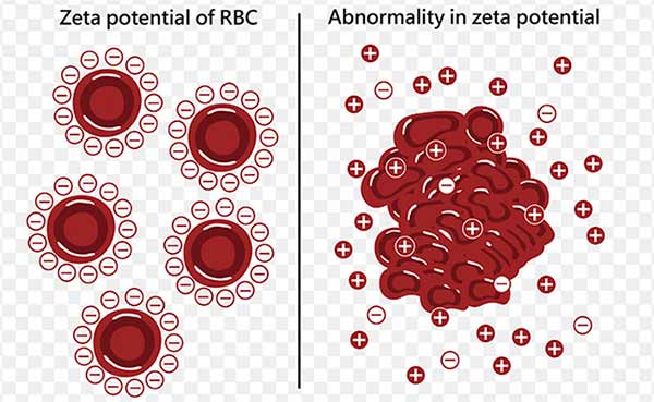 zeta potential