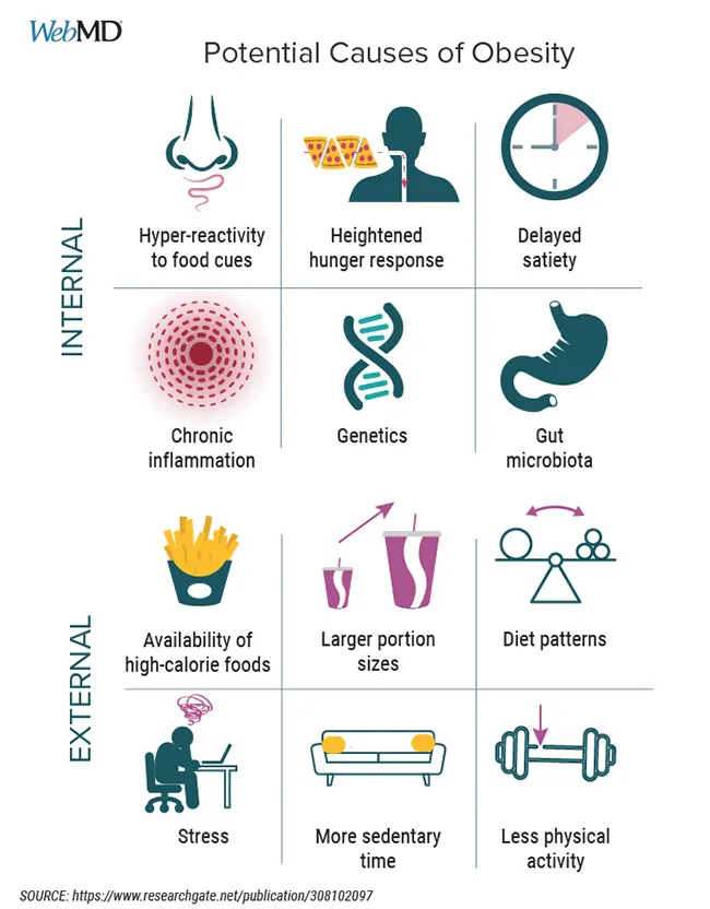 photo of obesity infographic