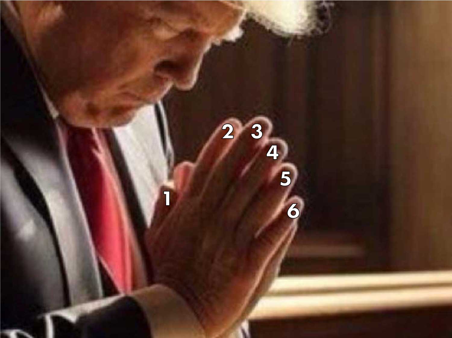 Trump has six fingers