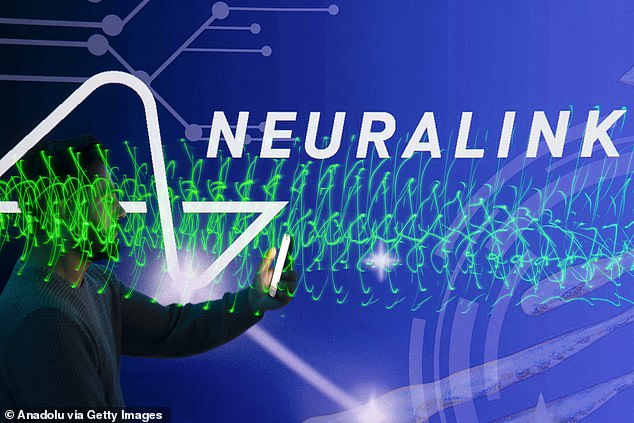 Big link: The Daily Mail, quoting 'a source with knowledge of the matter', revealed that Sondrel played a key part in developing Elon Musk's brain–computer interface Neuralink