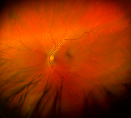 Close up view of the Retina in a human eye