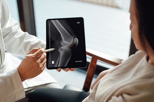 Elevated view of doctor explaining medical scan result with patient during medical consultation