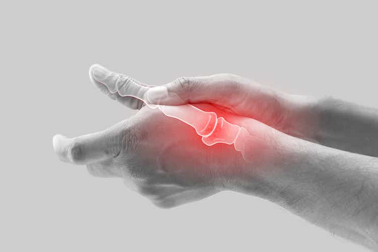 Arthritis of the finger and thumb joint.