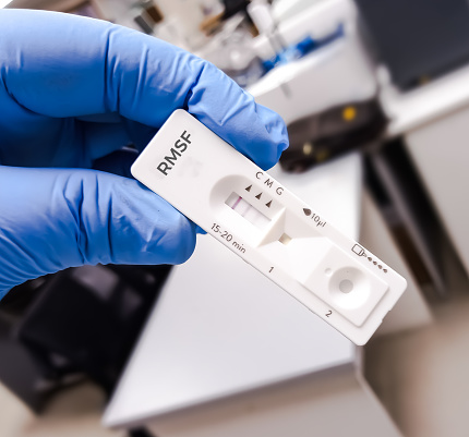 Rapid test kit for Rocky Mountain Spotted Fever(RMSF) antibodies IgG and IgM test.