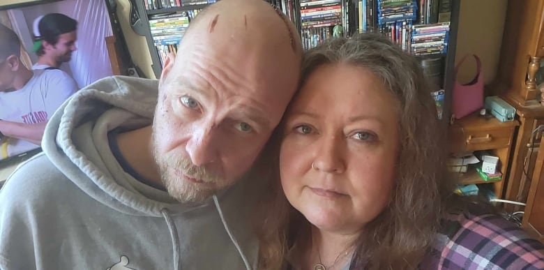 A couple take a selfie. The man has large gashes in his head.