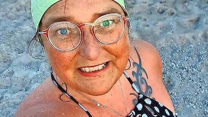 Gabriella Szűcs wurde beim Schwimmen in der Ostsee mehrfach von einem Neunauge gebissen.