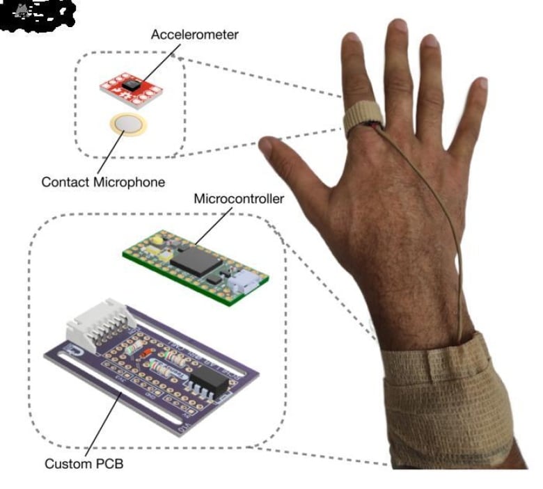 A diagram showing the parts of Akhil Padmanabha's wearable device to measure the intensity of scratching intensity shows a hand on the right wearing a ring with its components shown on the left. 