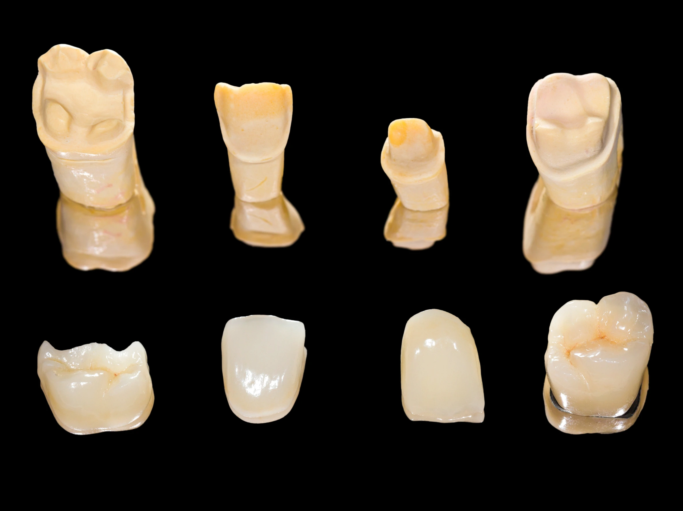 Dental Crowns