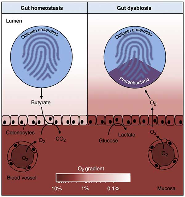 proteobacteria